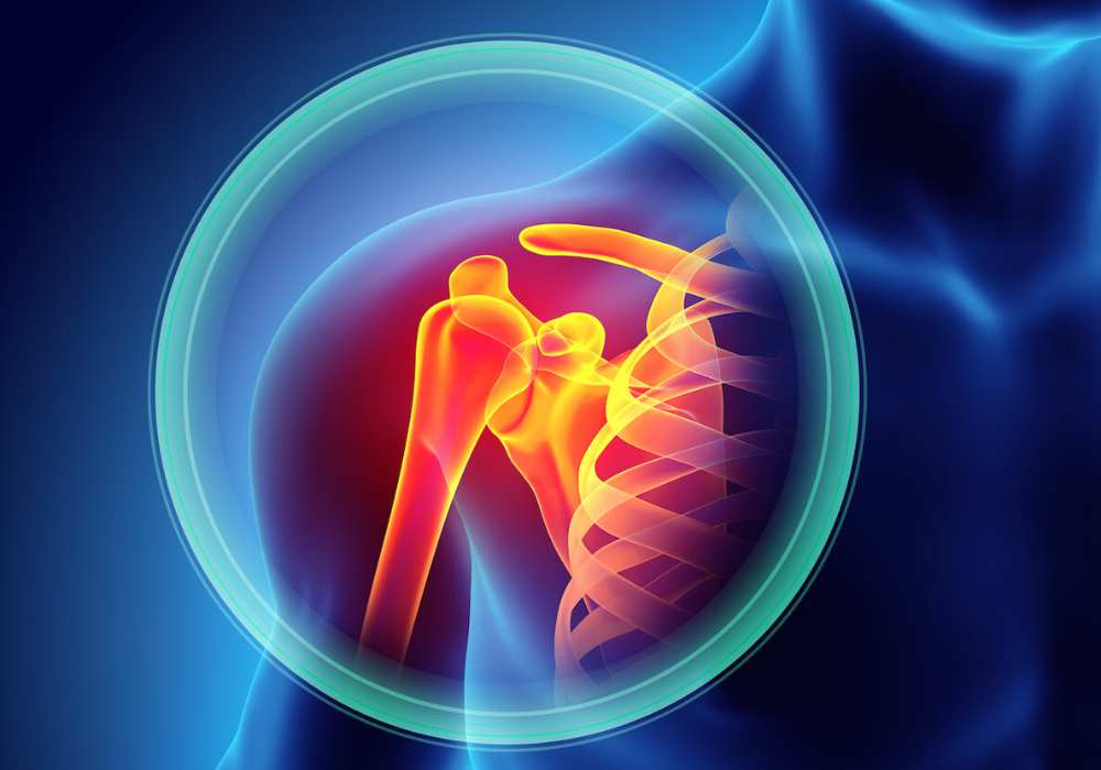 Shoulder Course 2024 | Arthroscopy Arthroplasty Fractures